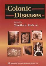 Colonic Diseases