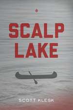 Scalp Lake