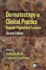 Dermatoscopy in Clinical Practice: Beyond Pigmented Lesions