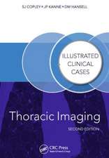 Thoracic Imaging