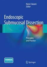 Endoscopic Submucosal Dissection: Principles and Practice