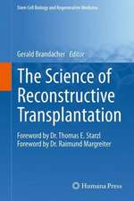 The Science of Reconstructive Transplantation