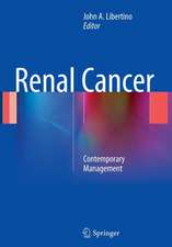 Renal Cancer: Contemporary Management