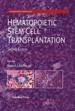 Hematopoietic Stem Cell Transplantation