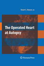 The Operated Heart at Autopsy