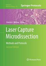 Laser Capture Microdissection: Methods and Protocols