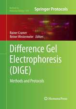 Difference Gel Electrophoresis (DIGE): Methods and Protocols