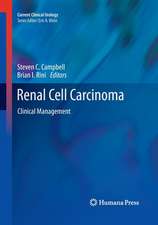 Renal Cell Carcinoma: Clinical Management