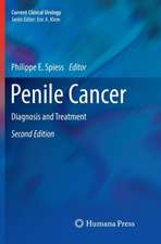 Penile Cancer: Diagnosis and Treatment