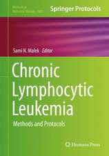 Chronic Lymphocytic Leukemia: Methods and Protocols 