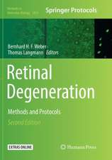 Retinal Degeneration: Methods and Protocols