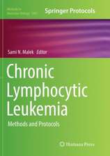 Chronic Lymphocytic Leukemia: Methods and Protocols