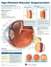 Age-Related Macular Degeneration Anatomical Chart