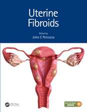 Uterine Fibroids