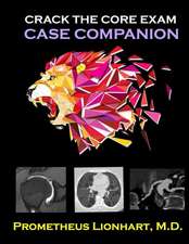 Crack the Core Exam - Case Companion