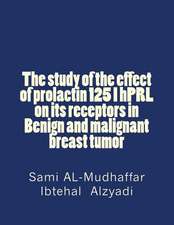 The Study of the Effect of Prolactin 125 I Hprl on Its Receptors in Benign and Malignant Breast Tumor