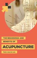 The Beginnings and Benefits of Acupuncture