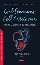 Oral Squamous Cell Carcinoma