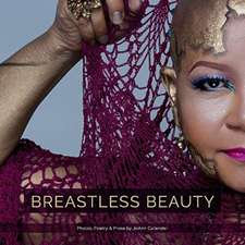 Breastless Beauty: A Collection of Poems and Photographs. Volume 1