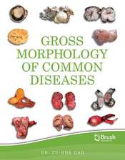 Gross Morphology of Common Diseases