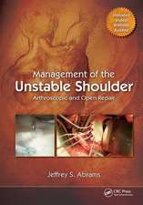 Management of the Unstable Shoulder: Arthroscopic and Open Repair