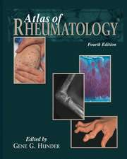 Atlas of Rheumatology