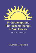 Phototherapy and Photochemotherapy for Skin Disease