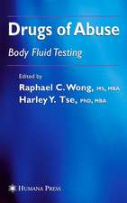 Drugs of Abuse: Body Fluid Testing