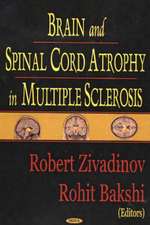 Brain and Spinal Cord Atrophy in Multiple Sclerosis