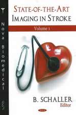 State-of-the-Art Imaging in Stroke