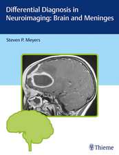 Differential Diagnosis in Neuroimaging: Brain and Meninges