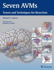 Seven AVMs – Tenets and Techniques for Resection