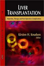 Liver Transplantation