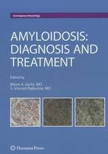 Amyloidosis: Diagnosis and Treatment