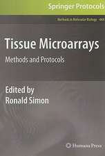 Tissue Microarrays