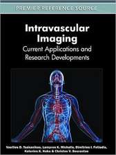 Intravascular Imaging