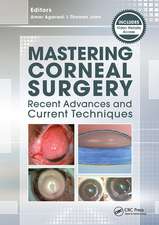 Mastering Corneal Surgery: Recent Advances and Current Techniques