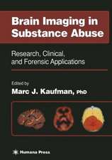 Brain Imaging in Substance Abuse: Research, Clinical, and Forensic Applications