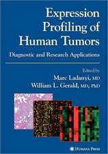 Expression Profiling of Human Tumors: Diagnostic and Research Applications