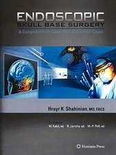 Endoscopic Skull Base Surgery: A Comprehensive Guide with Illustrative Cases