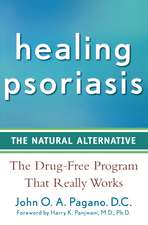 Healing Psoriasis: The Natural Alternative