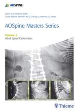 AOSpine Master Series, Vol. 4: Adult Spinal Deform ities