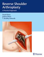 Reverse Shoulder Arthroplasty – A Practical Approach