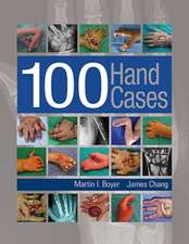 Boyer, M: 100 Hand Cases