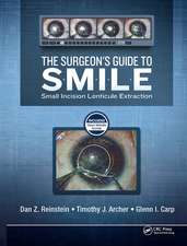 The Surgeon’s Guide to SMILE: Small Incision Lenticule Extraction