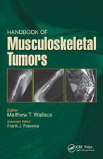 Handbook of Musculoskeletal Tumors