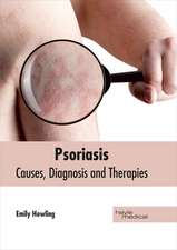 Psoriasis