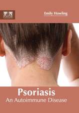 Psoriasis