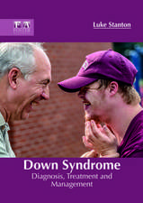 Down Syndrome