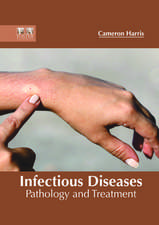 Infectious Diseases